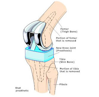 Mana Orthopaedics: Wellington Orthopaedic Surgeons